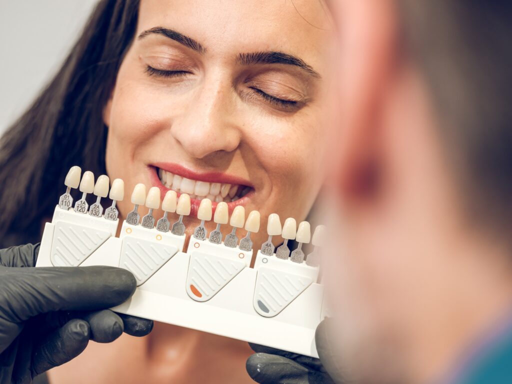 Dentist at Dental Professionals of Dardenne in Dardenne Prairie, MO, holding veneer shade samples to match a patient’s teeth for a custom smile makeover.